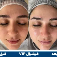 فیشال پوست