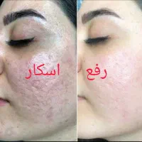 فشیال پاکسازی