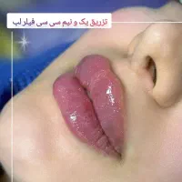 خدمات تخصصی تزریق ژل و بوتاکس|خدمات آرایشگری و زیبایی|فولادشهر, C3|دیوار