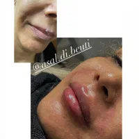 تخفیف ویژه ژل لب، فول فیس اموزش و تمام خدمات|خدمات آرایشگری و زیبایی|صدرا-فارس, فاز ۱|دیوار