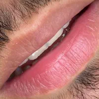 رفع تیرگی لب ،شیدینگ لب ،اسکالپ موی سر آقایون|خدمات آرایشگری و زیبایی|زاهدان, |دیوار