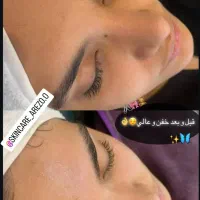 فشیال پوست تقویت مو درمطب پزشک ویژه بانوان وآقایان|خدمات آرایشگری و زیبایی|شیراز, رازی|دیوار