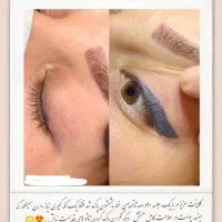 ریموو حرفه‌ای تاتو ابرو،لب وخط چشم تخفیف جشنواره