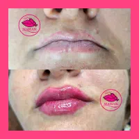آموزش وخدمات شیدینگ لب بن مژه ژل بوتاکس پرسینگ