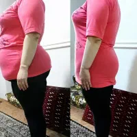 بهترین روش لاغری یک جلسه رایگان باکرایولیپولیز