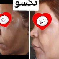 پوستی صاف وشفاف|آرایشی، بهداشتی، درمانی|قم, صفائیه|دیوار