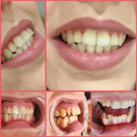 ارتودنسی لبخندی زیبا(فقط تا آخر ماه)|خدمات آرایشگری و زیبایی|مشهد, آزادشهر|دیوار