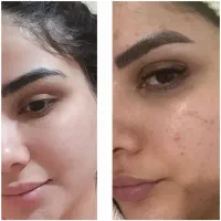 مشاوره رایگان پوست و مو