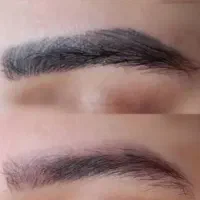 تخفیف ویژه میکروبلیدینگ و مزونیدلینگ، ریموو، پلکسر|خدمات زیبایی و سلامت|تهران, چهارصد دستگاه|دیوار