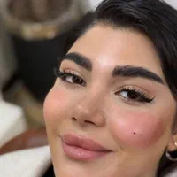 جشنواره تزریق ژل و بوتاکس/آموزش تخصصی/فشیال تخصصی|خدمات آرایشگری و زیبایی|اندیشه, اندیشه فاز ۱|دیوار