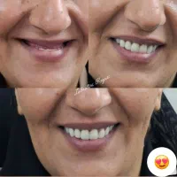 دندانسازی رضایی