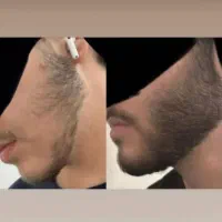 روغن ریش و سبیل