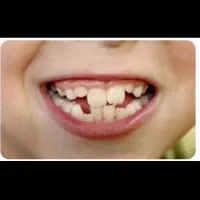 دستیار دندان پزشک مسلط ب ارتودنسی