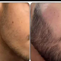 اینم آخرین شانسه ریشاته