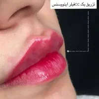 تخفیفات آنزیم بوتاکس صورت فیلر فول فیس و...|خدمات آرایشگری و زیبایی|مشهد, شهید فرامرز عباسی|دیوار