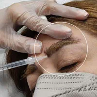مدل بوتاکس ژل مزوتراپی میکرونیدلینگ فشیال|خدمات آرایشگری و زیبایی|فردیس, طالقانی|دیوار