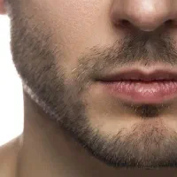 تزریق فیلرلب،ژل،شیدینگ،هایفوبدون پیشکاملااقساط|خدمات آرایشگری و زیبایی|اردبیل, |دیوار