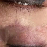 مدل برای تاتو صورت وریمور نیازمندم فقط هزینه مواد