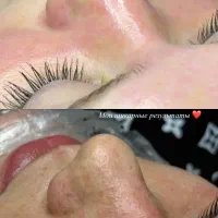 آموزش تخصصی پاکسازی پوست