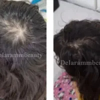 لیفتینگ ژل و بوتاکس خونگی کرمپودر پنکک لاکچری کوبن|آرایشی، بهداشتی، درمانی|تهران, بوستان چیتگر|دیوار