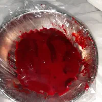 حجامت .فصد . بادکش