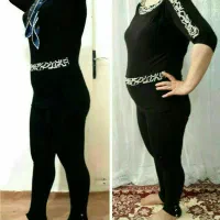 ژل لاغری شکم وپهلو‌وبازو بینی وغبغب اصل|آرایشی، بهداشتی، درمانی|اسلام‌‌آباد غرب, |دیوار