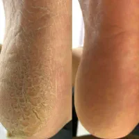 آموزش وخدمات تخصصی پدیکور واسپا درجشنواره پاییزه|خدمات آموزشی|زنجان, |دیوار