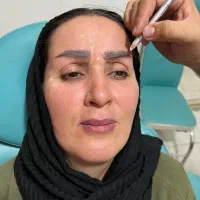 جشنواره  PRP و بوتاکس / ۶۰درصد تخفیف واقعی