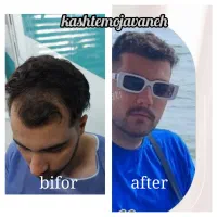 جشنواره یلدایی کاشت موشیرازی از۱۳تومن|خدمات آرایشگری و زیبایی|تهران, صد دستگاه|دیوار