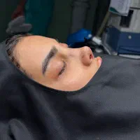 عمل بینی فقط و فقط ۳۸میلیون