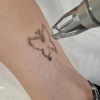 پاک کردن تاتو بدون درد با دستگاه کیوسوئیچ پیکوسکند|خدمات آرایشگری و زیبایی|ساری, |دیوار