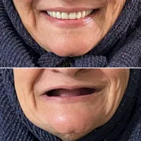 دندان مصنوعی و دندانسازی ، خدمات دندان سازی|خدمات آرایشگری و زیبایی|مشهد, شفا|دیوار