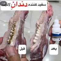 تمیزی دندان فوری تضمینی|آرایشی، بهداشتی، درمانی|قم, مجیدیه|دیوار