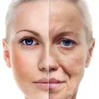 لیفت صورت بدون جراحی و تزریق (لیفت ژاپنی)