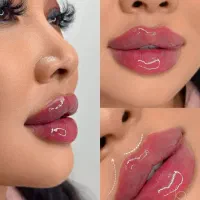 آموزش ژل وبوتاکس  تخصصی توسط پزشک درکلینیک زیبایی