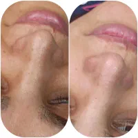 آموزش مقدماتی و تخصصی پاکسازی پوست|خدمات آموزشی|شاهرود, |دیوار