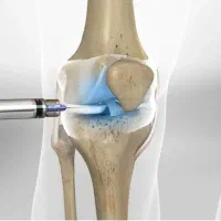 خدمات درمانی درمنزل تزریقات سونوگرافی اکو طب سوزنی|خدمات زیبایی و سلامت|مشهد, ارشاد|دیوار