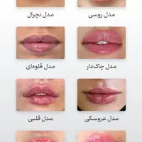 تخفیفات خدمات زیبایی فیلر بوتاکس نخ لیزر پاکسازی|خدمات آرایشگری و زیبایی|یزد, |دیوار