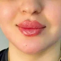 کلینیک زیبایی دکتر نازنین نعمتی/خدمات بوتاکس،ژل،نخ|خدمات آرایشگری و زیبایی|تهران, مرزداران|دیوار