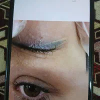 محو کردن تاتو قدیمی و فیشیال تخصصی صورت