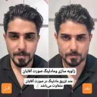 جشنواره پک مادلینگ +بوتاکس رایگان(فک لب گونه چانه)|خدمات آرایشگری و زیبایی|قم, زنبیل آباد|دیوار