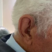 تجویز سمعک‌ فراهوشمند شارژی|پزشکی|تهران, نیاوران|دیوار