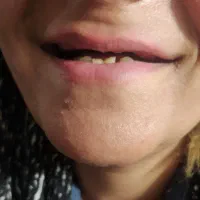 دندان مصنوعی با بهترین کیفیت و قیمت پایین|خدمات آرایشگری و زیبایی|نیشابور, سرآب کوشک|دیوار