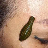 حجامت و فصدخون تخصصی (خال برداری) زالو