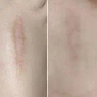 تخفیف روز مادر|آرایشی، بهداشتی، درمانی|مسجد سلیمان, |دیوار