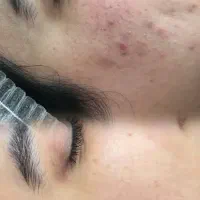 آف ویژه فیشال تخصصی به مناسبت روز پزشک وهمدان