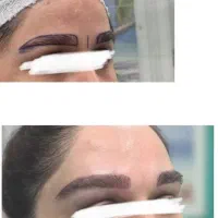 متخصص کاشت ابروتهران/قرینه/اقساطی|خدمات زیبایی و سلامت|تهران, صادقیه|دیوار