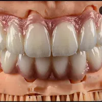 دوره آموزشی دندانسازی. ظرفیت محدود