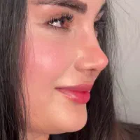 تخفیف عمل بینی لیپو ابدو ساکشن پیکرتراشی و لیفت|خدمات آرایشگری و زیبایی|بروجرد, |دیوار