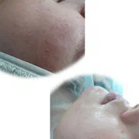 ارائه خدمات فیشال  و پاکسازی صورت با بهترین متریال|خدمات آرایشگری و زیبایی|مشهد, عبادی|دیوار